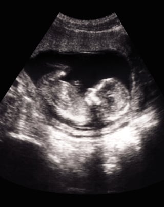 Call for Papers Maternal Health